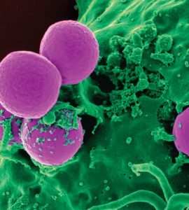 Human white blood cells ingesting Methicillin-resistant Staphylococcus aureus (MRSA) bacteria