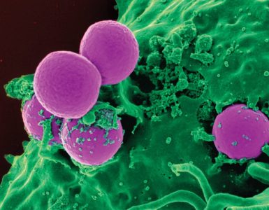 Human white blood cells ingesting Methicillin-resistant Staphylococcus aureus (MRSA) bacteria