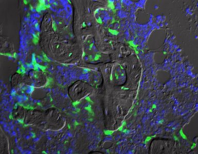 A phase-contrast image of transplanted mesenchymal stem cells in a mouse bone.