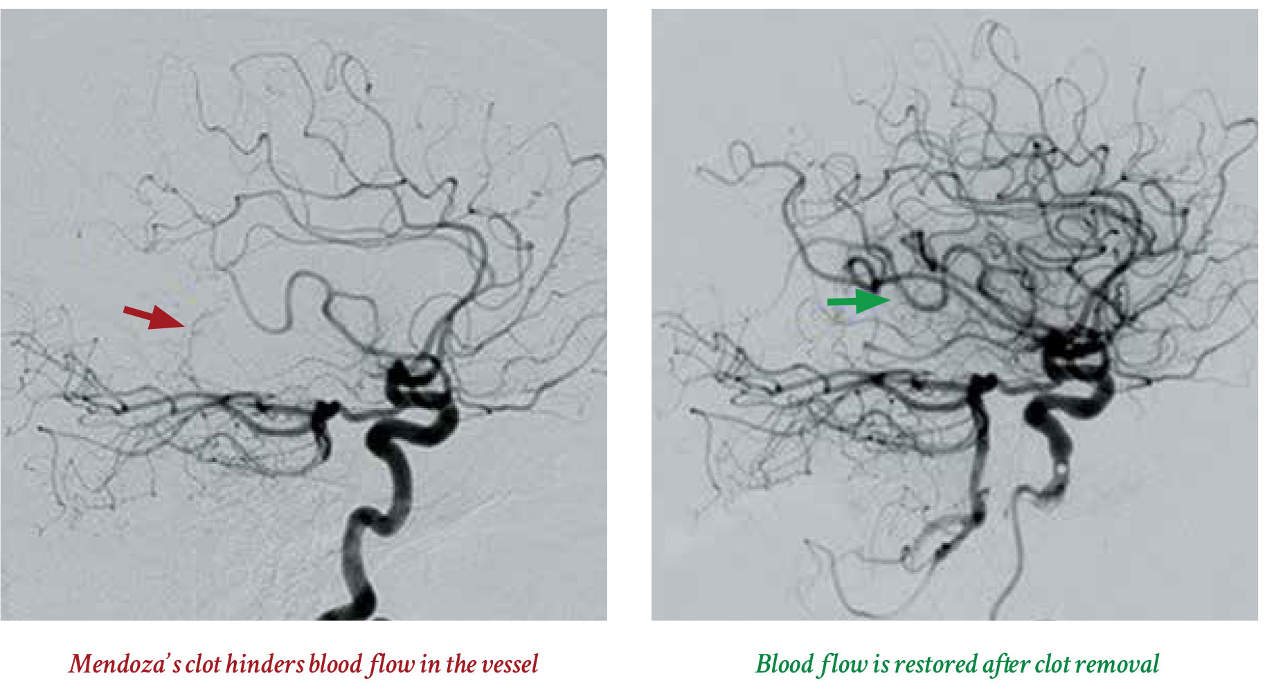 blood flow