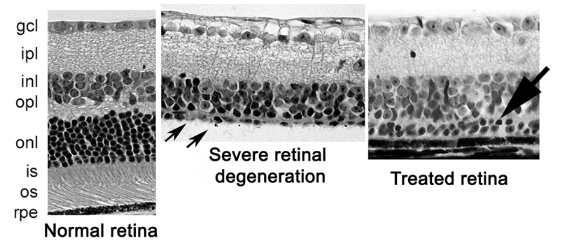 retinal image