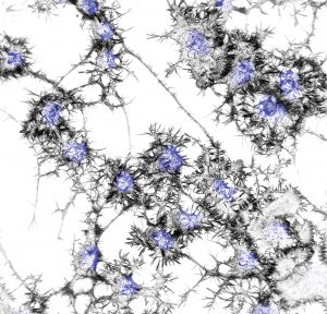 digital drawing of neuronal cells