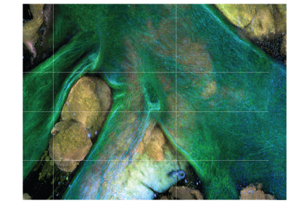 T cells in the aortic arch and nearby fat tissue