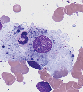 Phagocytic-macrophage