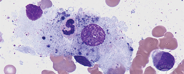 Phagocytic-macrophage