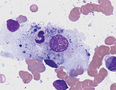 Phagocytic-macrophage