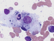 Phagocytic-macrophage