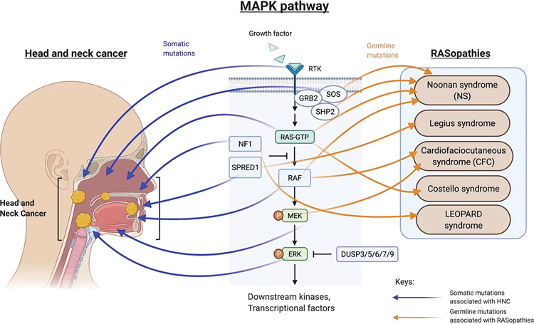 drawing of head and neck cancer and research